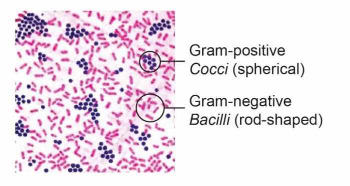 All of the following are characteristics of campylobacter jejuni except